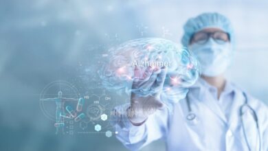 أسباب غير متوقعة للإصابة بمرض الزهايمر