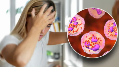 تفشي مرض المكورات السحائية