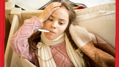 عودة كبيرة للحصبة في أوروبا