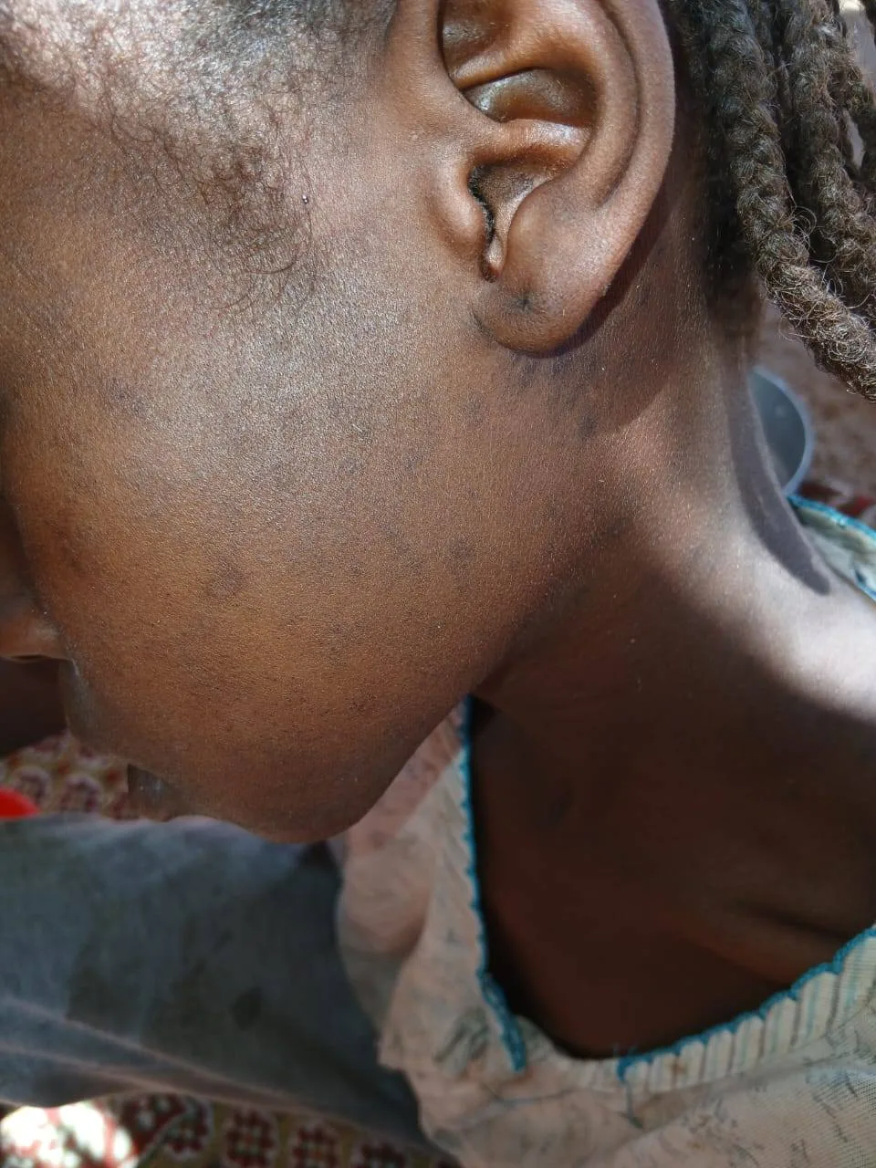 كارثة صحية تضرب كبكابية والأرقام صادمة